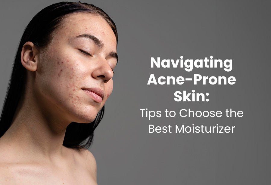 Navigating Acne-Prone Skin: Tips to Choose the Best Moisturizer