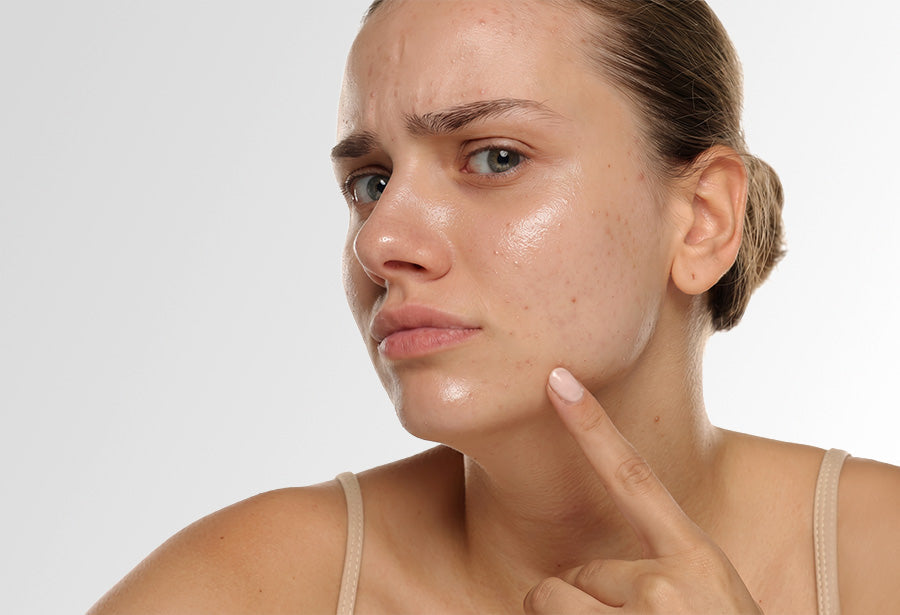 Skin Care Routine for Oily Skin
