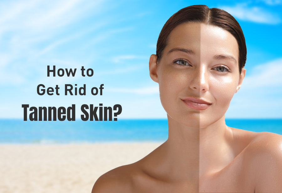 How to Get Rid of Tanned Skin And Why Prevention Is the Real Hero?