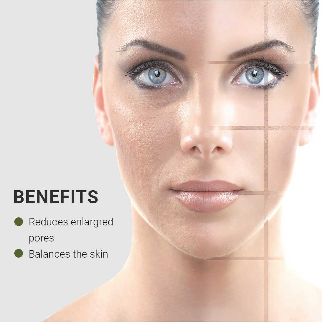Pore Normalising Factor