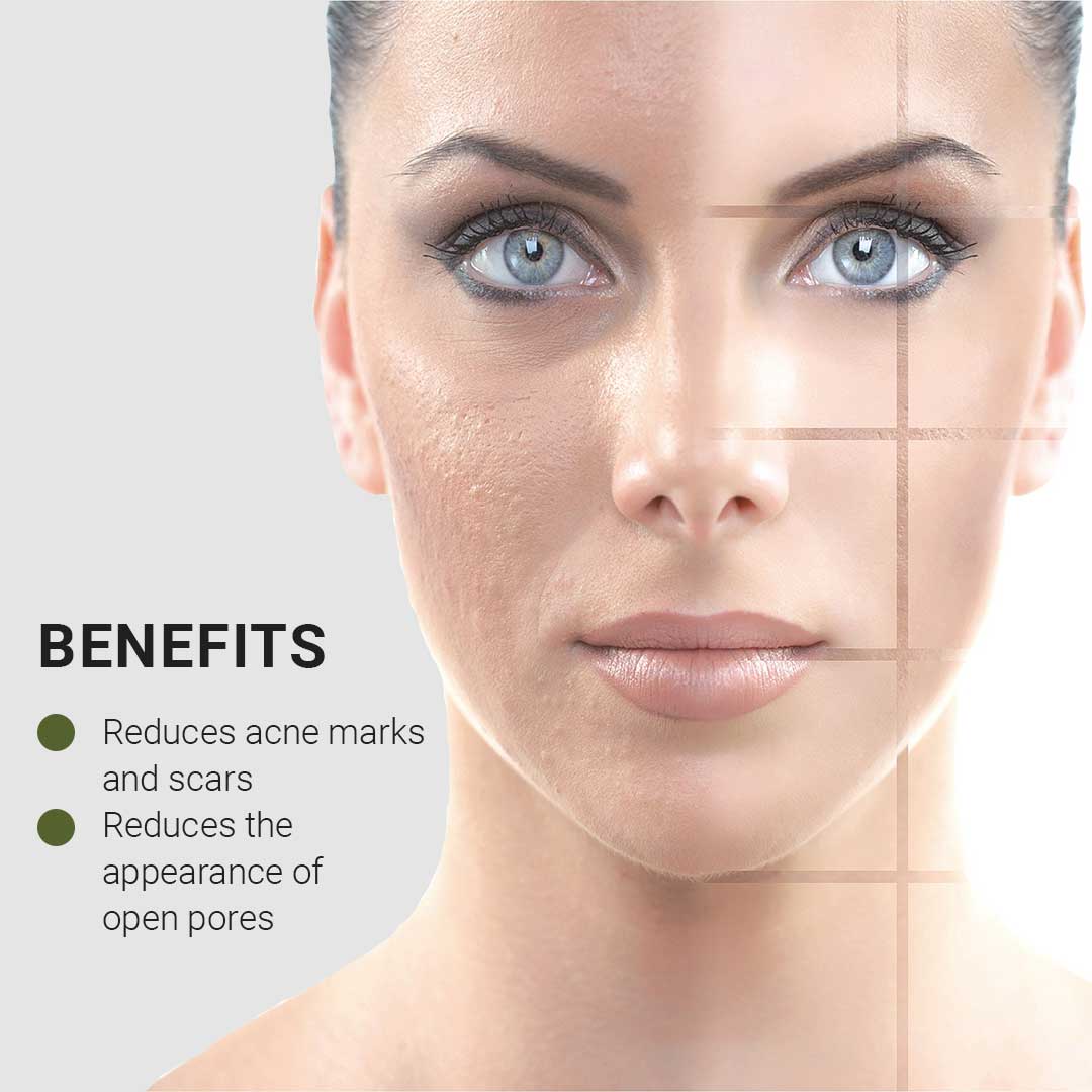 Pore Refining Repair Serum