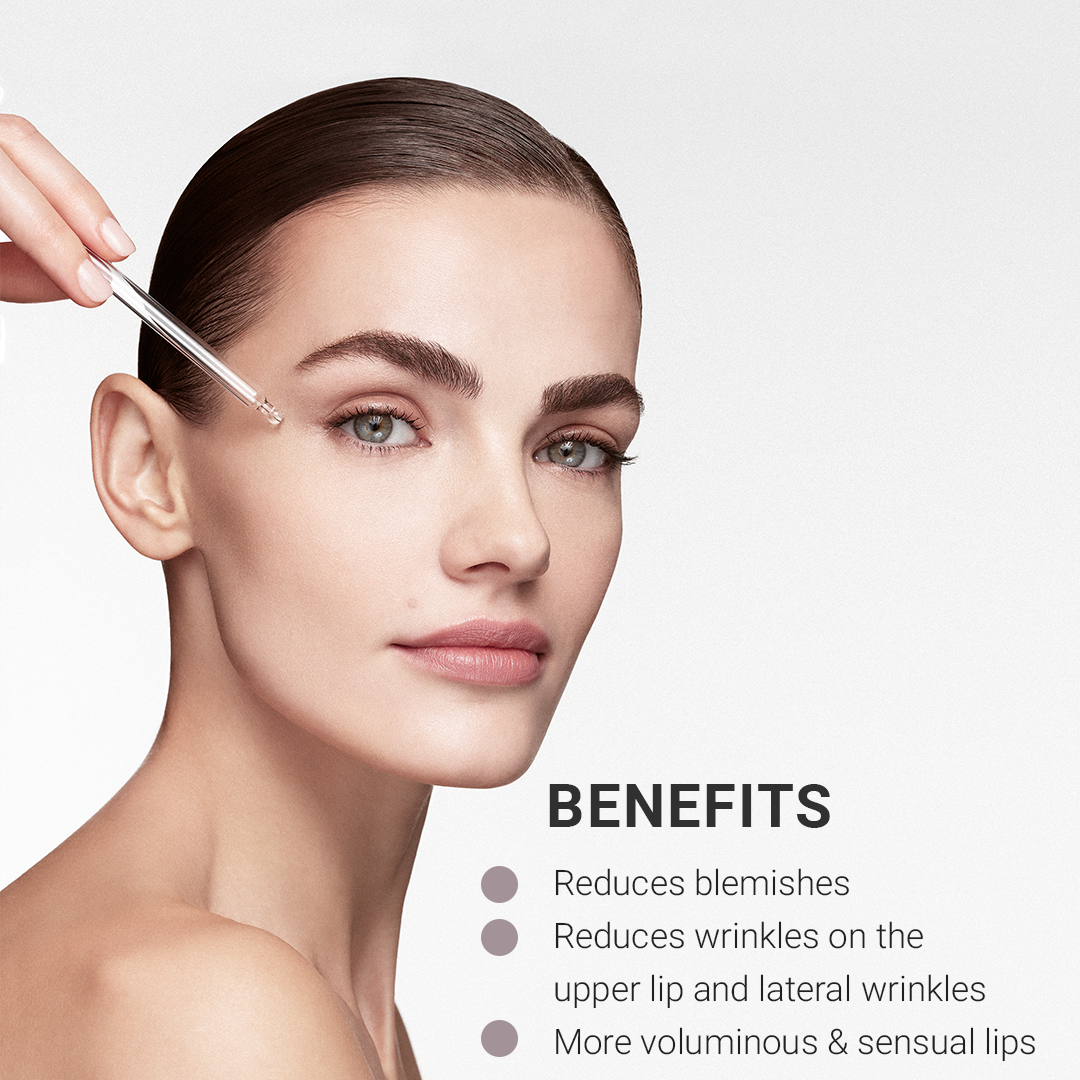Expression Line - Lip Filler Contour